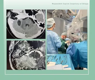 Zespół otolaryngologów przeprowadził szereg skomplikowanych operacji